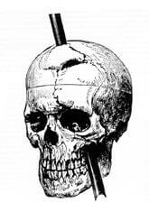 phineas gage case study psychology
